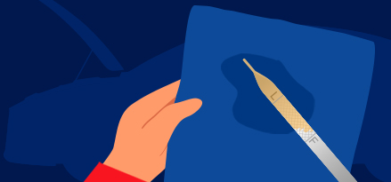 kontroll av motoroljan